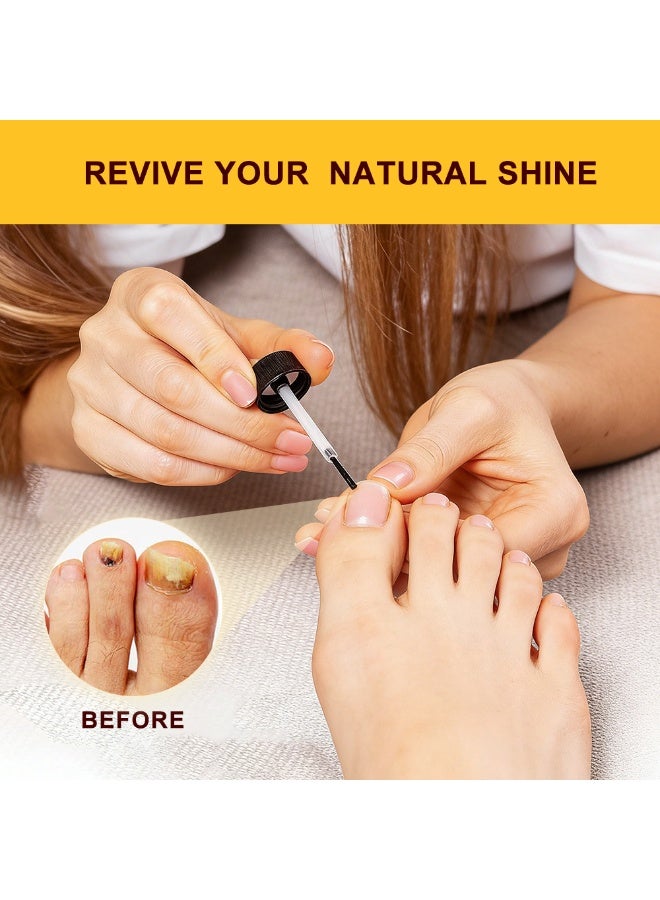 سوميفون محلول سومي فن للعناية بالأظافر: ٢٠ مل - يُصلح ويُقوي الأظافر، ويُعالج الأظافر الهشة، ويُغذيها للحصول على سطح أظافر صحي ولامع. - Image 2